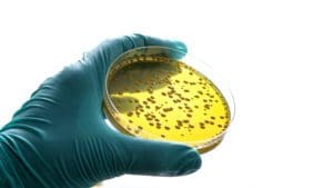 A hand wearing green latex gloves holding a petri dish that contains bacteria and viral matter. 